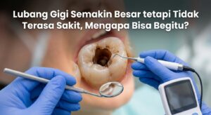 Lubang Gigi Semakin Besar tetapi Tidak Terasa Sakit, Mengapa Bisa Begitu?